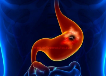 அல்சரை குணப்படுத்தும் ஒரு சில உணவுகள்