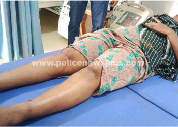 நடை பயிற்சியில் ஈடுபட்ட நபரை  நாய்கள் கடித்ததால் மருத்துவமனையில் அனுமதி