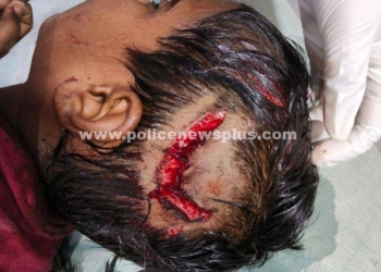 பலத்த காயங்களுடன் சிறுவன் மருத்துவமனையில் அனுமதி